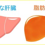 脂肪肝はお酒だけじゃないよ…気をつけたい食べ物と飲み物