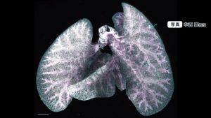 “老化細胞の除去”人類は不老不死を手に入れたかも？