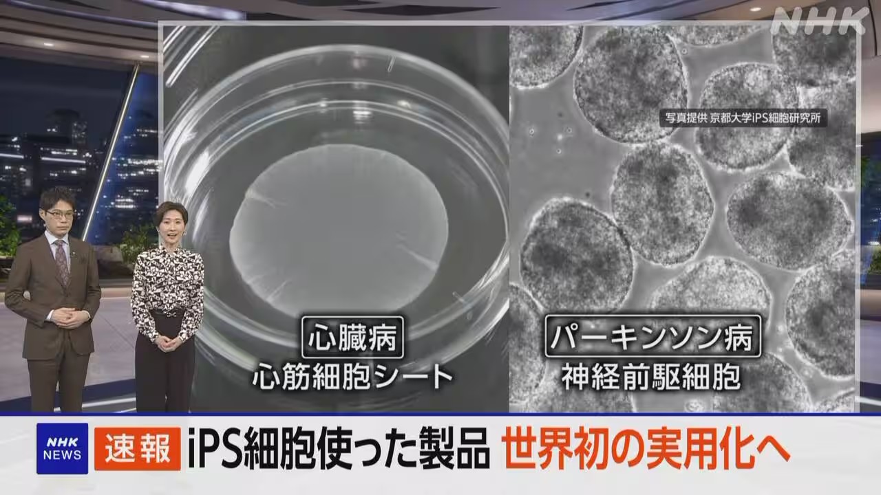 iPS細胞が拓く再生医療：心臓と脳の難病治療