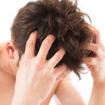 頭皮のひどいかゆみ、可能性のある病気は？基本はシャンプー