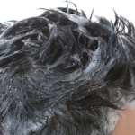 育毛剤とシャンプーの相性ってどうなの？やっぱり抜け毛や薄毛に効果的！