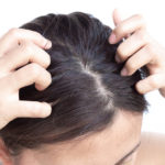 頭を叩くと髪が生える？？信じる者は救われる…噂のものとは