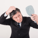白髪と薄毛一般的にはどっちがマシ？