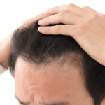 白髪染めと育毛剤のミノキシジルの併用は？危険はないの？？